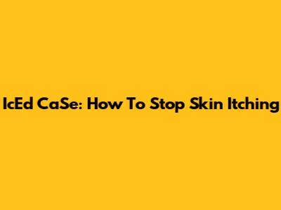 IcEd CaSe: How To Stop Skin Itching