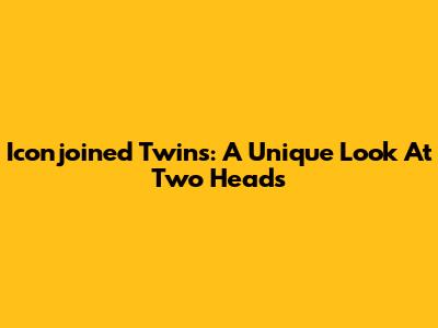 Iconjoined Twins: A Unique Look At Two Heads