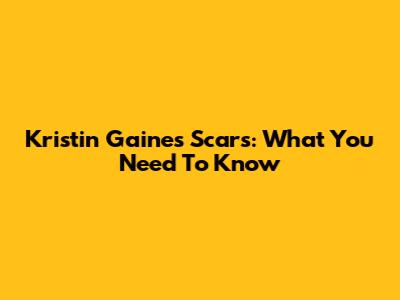 Kristin Gaines' Scars: What You Need To Know