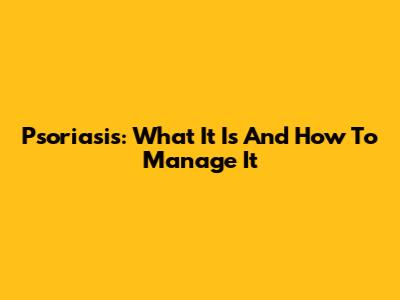 Psoriasis: What It Is And How To Manage It