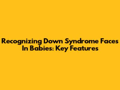 Recognizing Down Syndrome Faces In Babies: Key Features