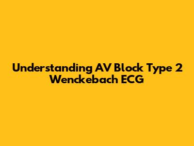 Understanding AV Block Type 2 Wenckebach ECG